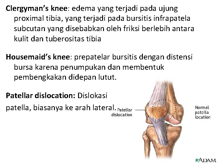 Clergyman’s knee: edema yang terjadi pada ujung proximal tibia, yang terjadi pada bursitis infrapatela