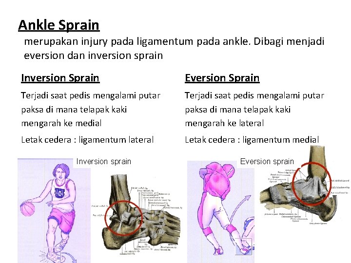 Ankle Sprain merupakan injury pada ligamentum pada ankle. Dibagi menjadi eversion dan inversion sprain