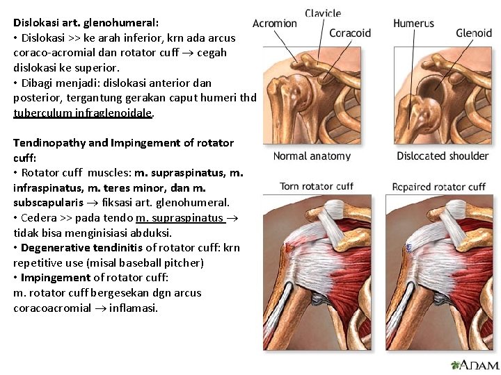 Dislokasi art. glenohumeral: • Dislokasi >> ke arah inferior, krn ada arcus coraco-acromial dan