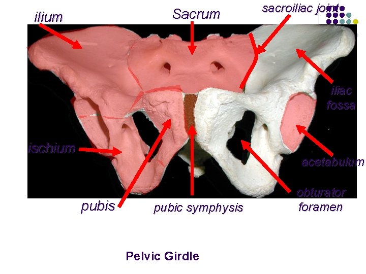 Sacrum ilium sacroiliac joint iliac fossa ischium acetabulum pubis pubic symphysis Pelvic Girdle obturator