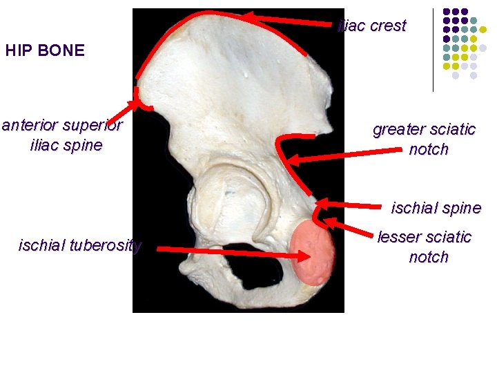 iliac crest HIP BONE anterior superior iliac spine greater sciatic notch ischial spine ischial