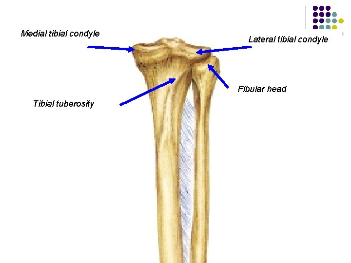 Medial tibial condyle Lateral tibial condyle Fibular head Tibial tuberosity 