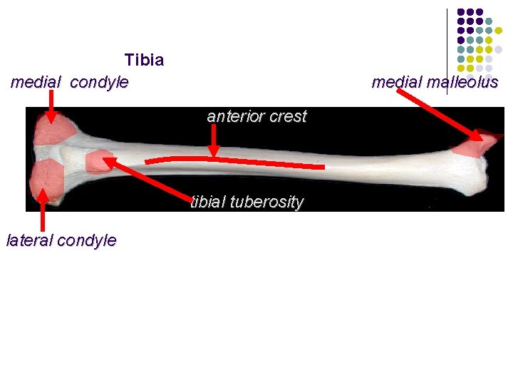 Tibia medial condyle medial malleolus anterior crest tibial tuberosity lateral condyle 