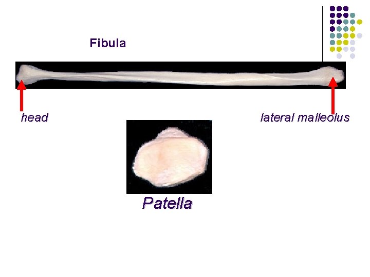 Fibula lateral malleolus head Patella 
