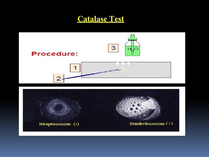 Catalase Test 
