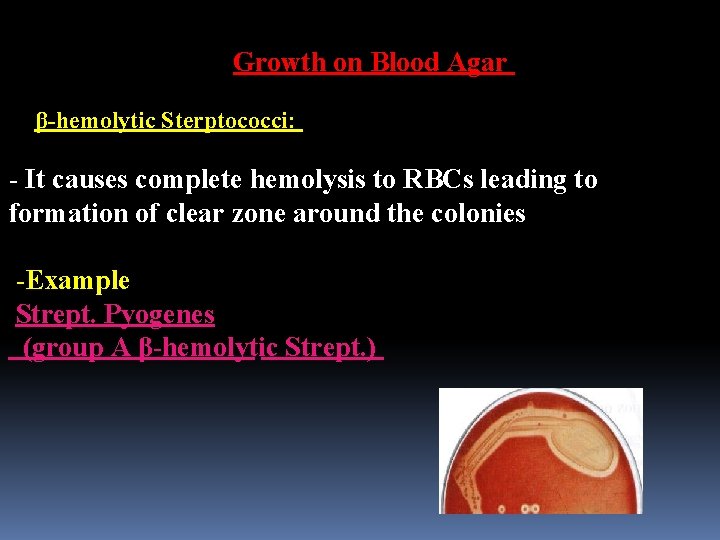 Growth on Blood Agar β-hemolytic Sterptococci: - It causes complete hemolysis to RBCs leading