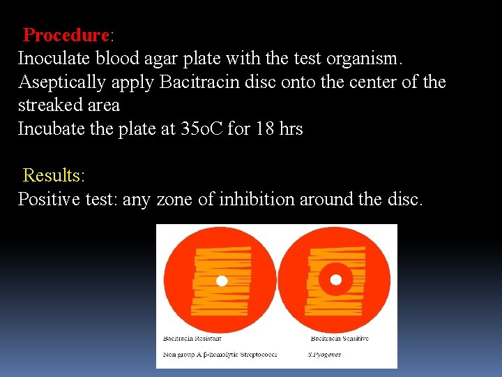 Procedure: Inoculate blood agar plate with the test organism. Aseptically apply Bacitracin disc onto