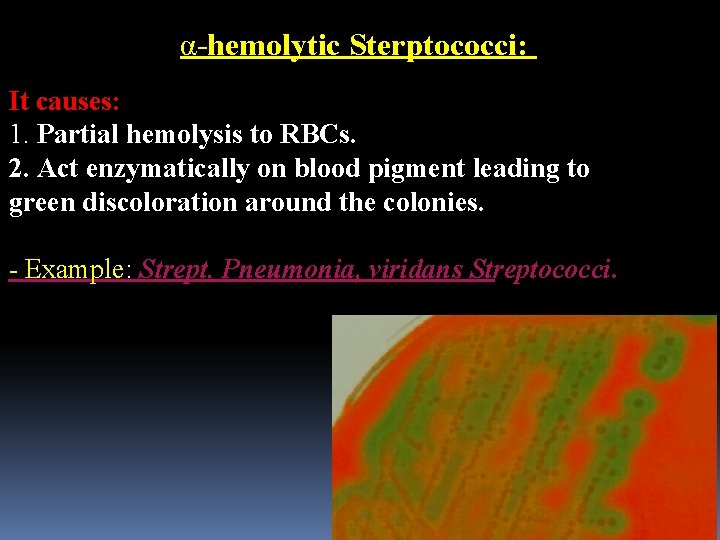 α-hemolytic Sterptococci: It causes: 1. Partial hemolysis to RBCs. 2. Act enzymatically on blood