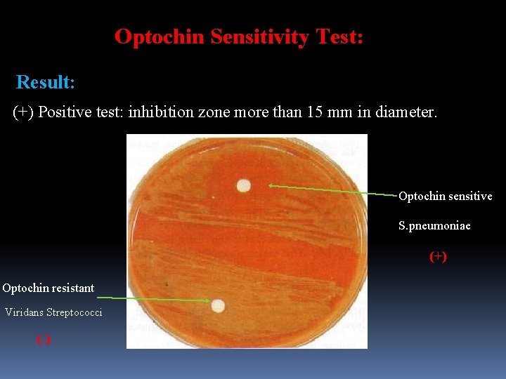 Optochin Sensitivity Test: Result: (+) Positive test: inhibition zone more than 15 mm in