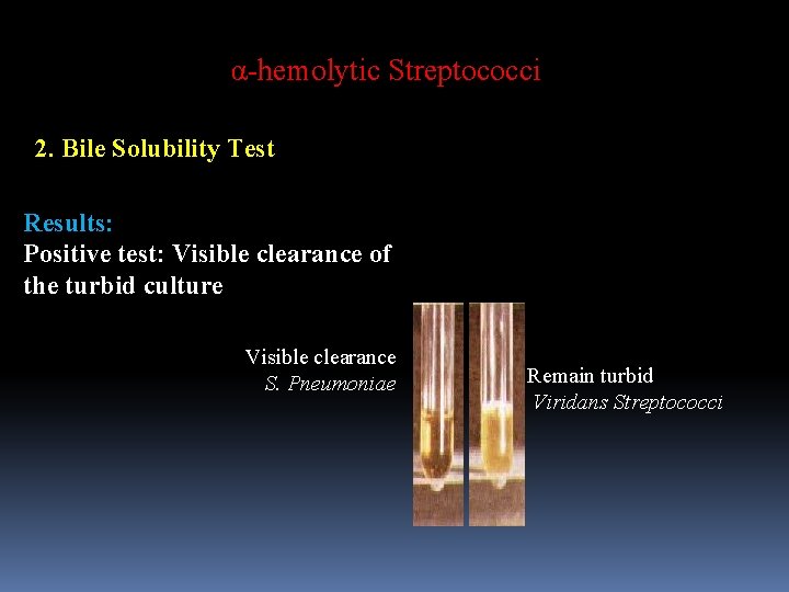 α-hemolytic Streptococci 2. Bile Solubility Test Results: Positive test: Visible clearance of the turbid