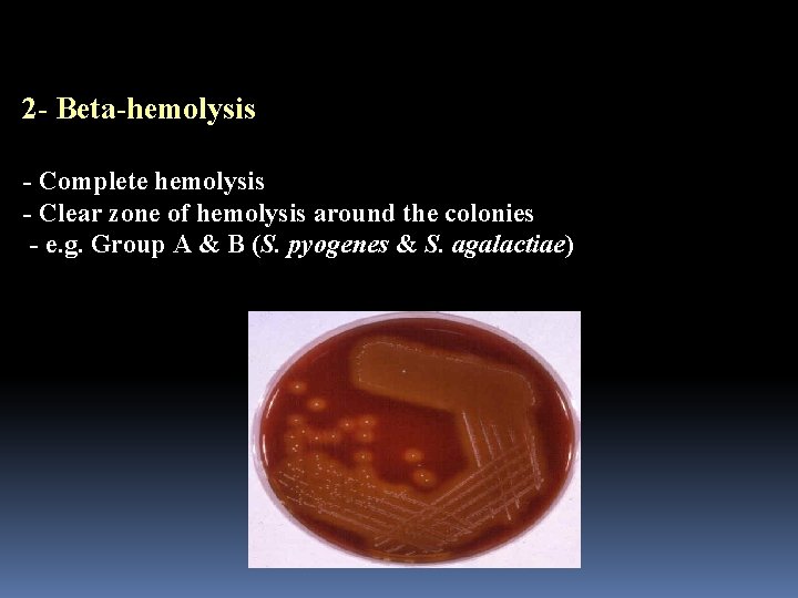 2 - Beta-hemolysis - Complete hemolysis - Clear zone of hemolysis around the colonies