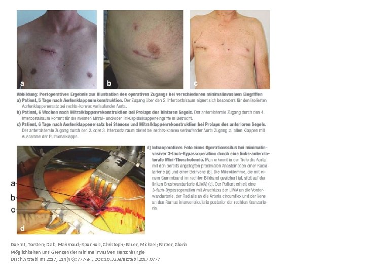 Doenst, Torsten; Diab, Mahmoud; Sponholz, Christoph; Bauer, Michael; Färber, Gloria Möglichkeiten und Grenzen der