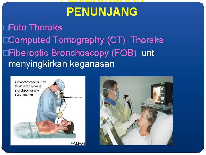 PEMERIKSAAN PENUNJANG �Foto Thoraks �Computed Tomography (CT) Thoraks �Fiberoptic Bronchoscopy (FOB) unt menyingkirkan keganasan