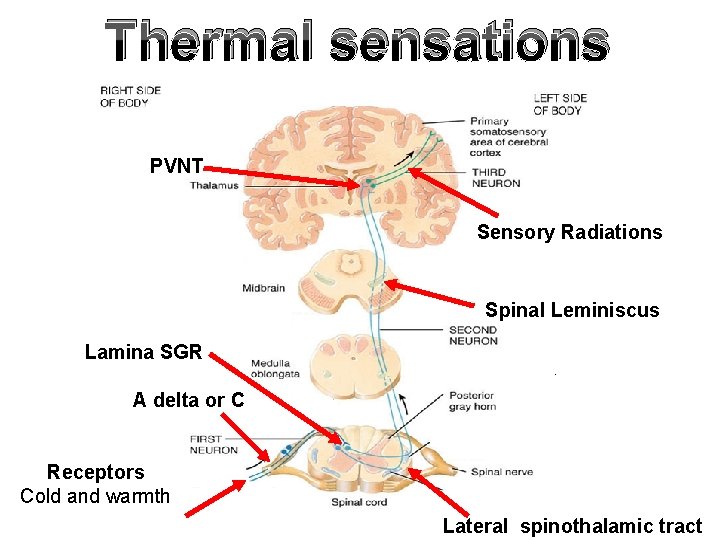 Thermal sensations PVNT Sensory Radiations Spinal Leminiscus Lamina SGR A delta or C Receptors