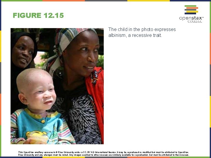 FIGURE 12. 15 The child in the photo expresses albinism, a recessive trait. This