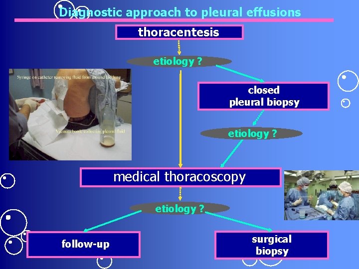 Diagnostic approach to pleural effusions thoracentesis etiology ? closed pleural biopsy etiology ? medical