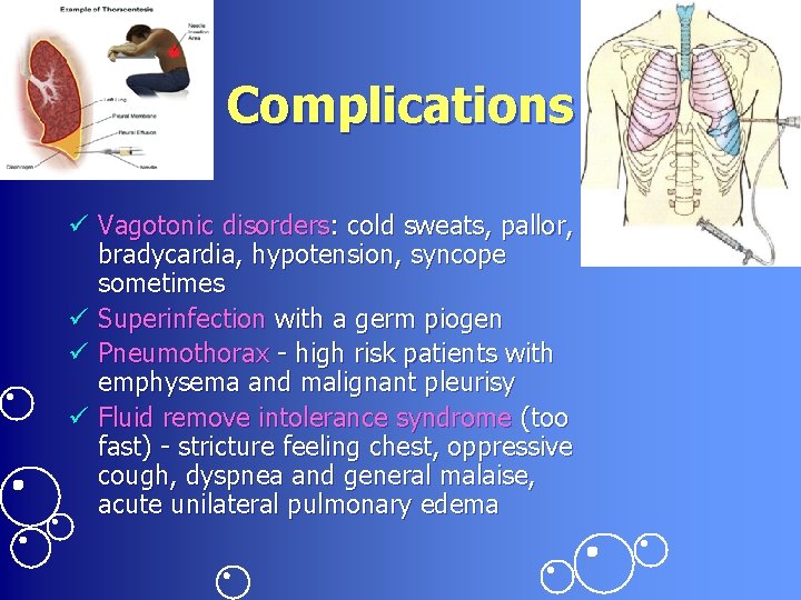 Complications ü Vagotonic disorders: cold sweats, pallor, bradycardia, hypotension, syncope sometimes ü Superinfection with