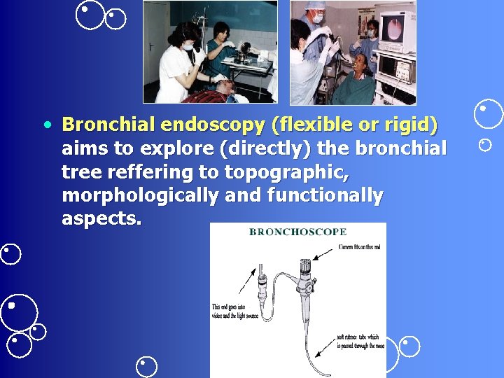  • Bronchial endoscopy (flexible or rigid) aims to explore (directly) the bronchial tree