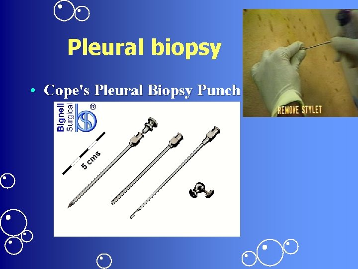 Pleural biopsy • Cope's Pleural Biopsy Punch 