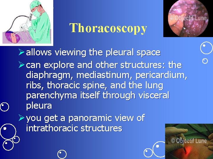 Thoracoscopy Ø allows viewing the pleural space Ø can explore and other structures: the