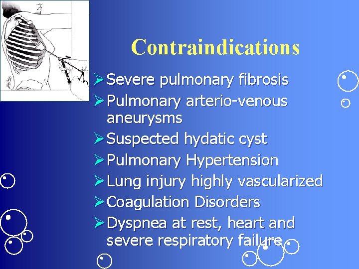 Contraindications Ø Severe pulmonary fibrosis Ø Pulmonary arterio-venous aneurysms Ø Suspected hydatic cyst Ø