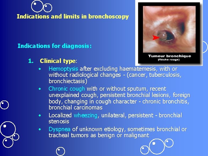 Indications and limits in bronchoscopy Indications for diagnosis: 1. Clinical type: • Hemoptysis after