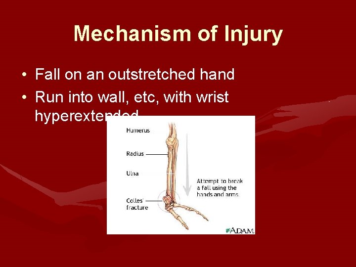 Mechanism of Injury • Fall on an outstretched hand • Run into wall, etc,