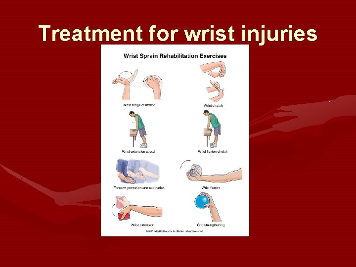 Treatment for wrist injuries Treatment for wrist injuries