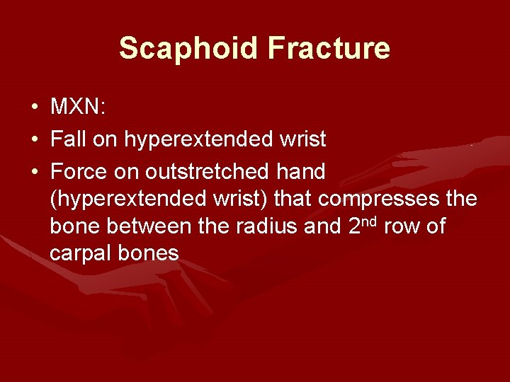 Scaphoid Fracture • MXN: • Fall on hyperextended wrist • Force on outstretched hand