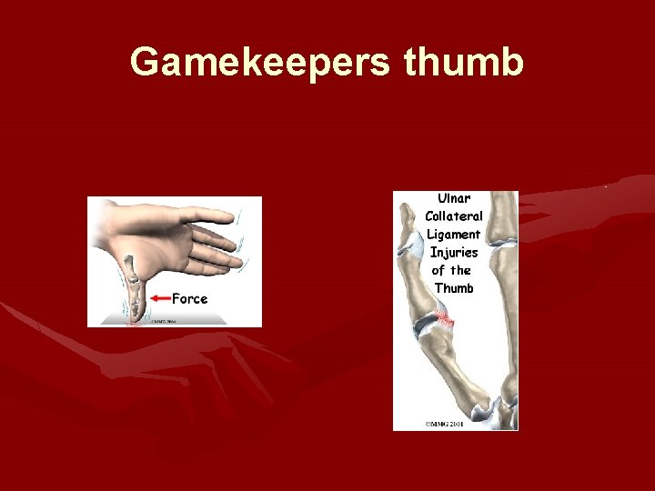 Gamekeepers thumb Gamekeepers thumb