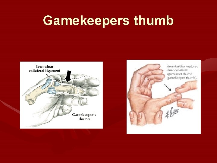 Gamekeepers thumb 