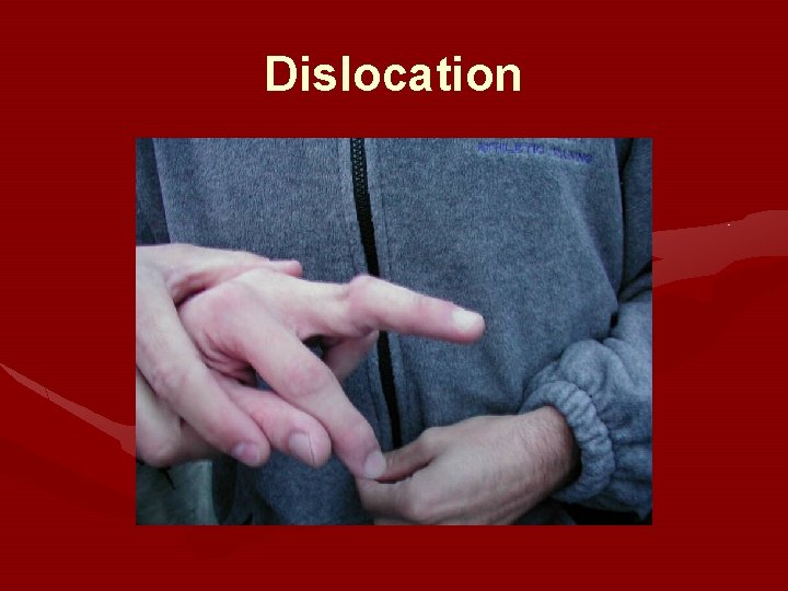 Dislocation 