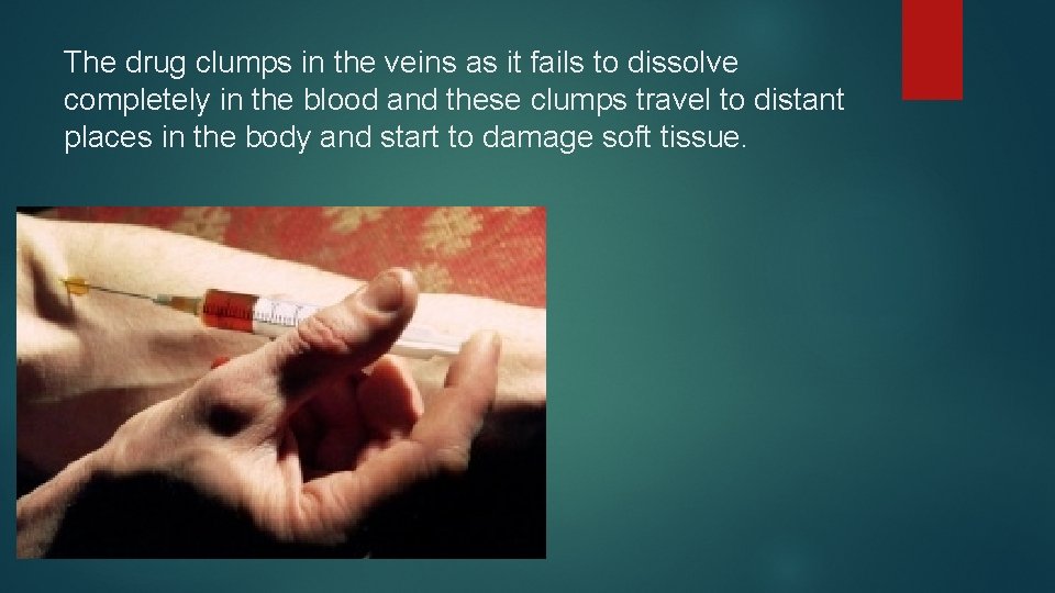 The drug clumps in the veins as it fails to dissolve completely in the The drug clumps in the veins as it fails to dissolve completely in the