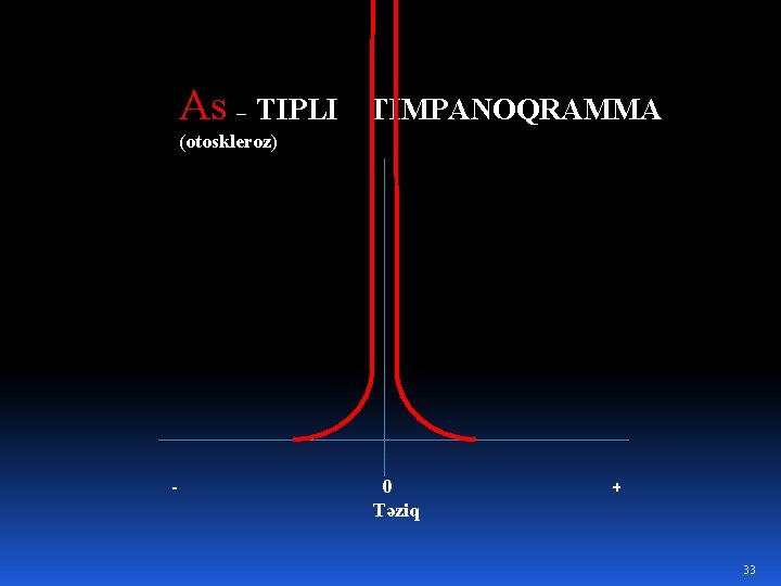 As – TIPLI TIMPANOQRAMMA (otoskleroz) - 0 Təziq + 33 