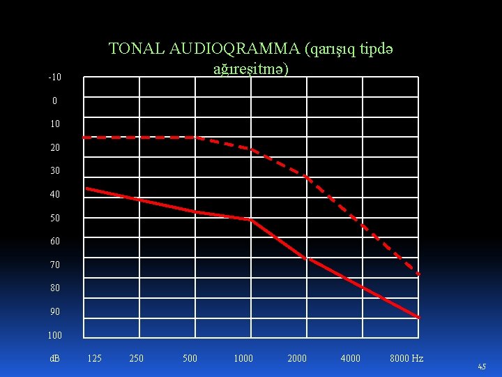 TONAL AUDIOQRAMMA (qarışıq tipdə ağıreşitmə) -10 0 10 20 30 40 50 60 70