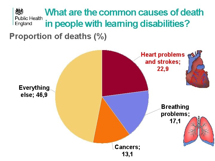 What are the common causes of death in people with learning disabilities? Proportion of