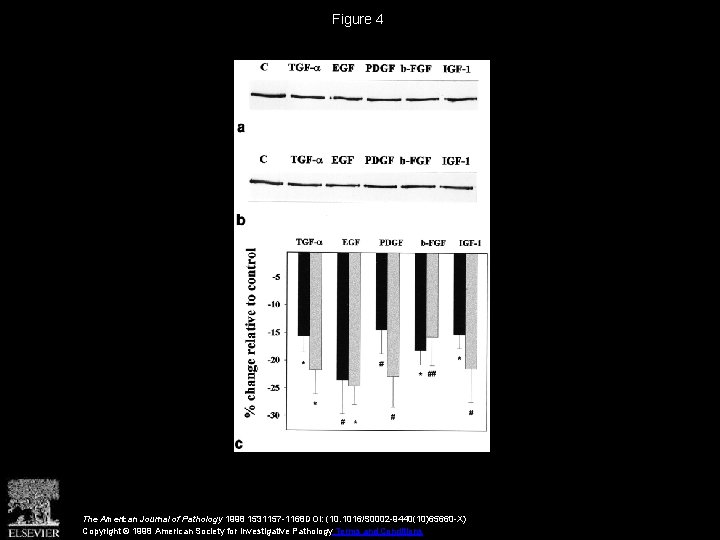 Figure 4 The American Journal of Pathology 1998 1531157 -1168 DOI: (10. 1016/S 0002