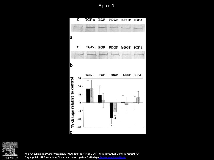 Figure 5 The American Journal of Pathology 1998 1531157 -1168 DOI: (10. 1016/S 0002