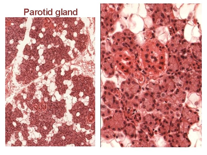 Parotid gland 