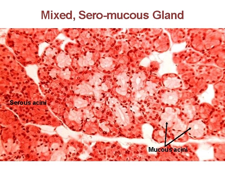 Mixed, Sero-mucous Gland Serous acini Mucous acini 