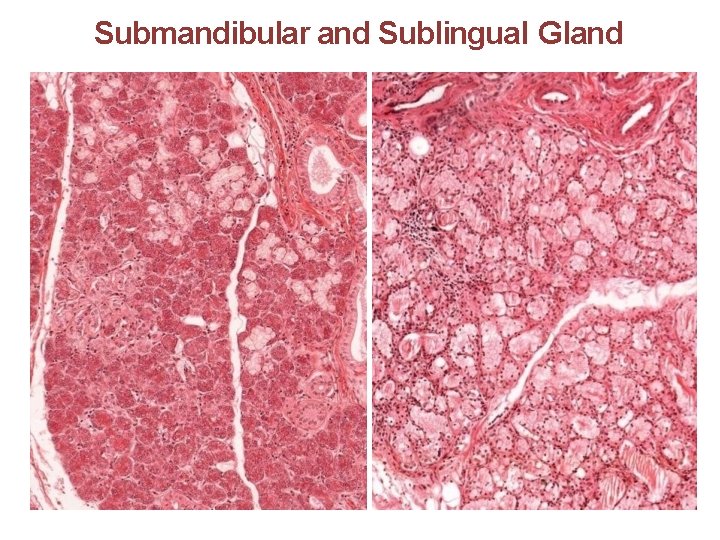 Submandibular and Sublingual Gland 