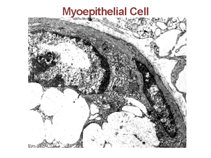 Myoepithelial Cell 