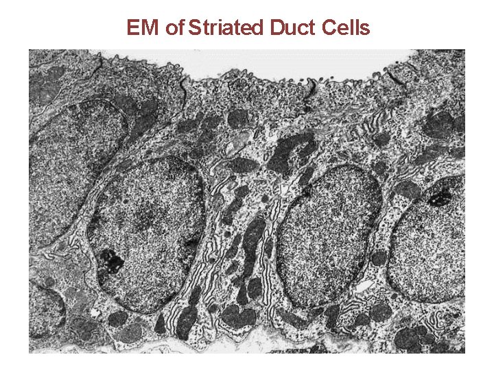 EM of Striated Duct Cells 