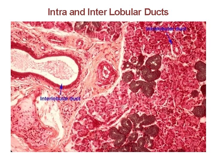 Intra and Inter Lobular Ducts 