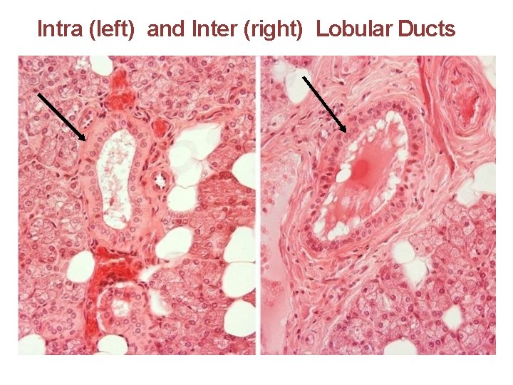 Intra (left) and Inter (right) Lobular Ducts 