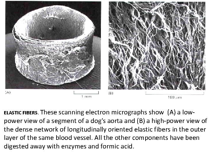 ELASTIC FIBERS. These scanning electron micrographs show (A) a lowpower view of a segment