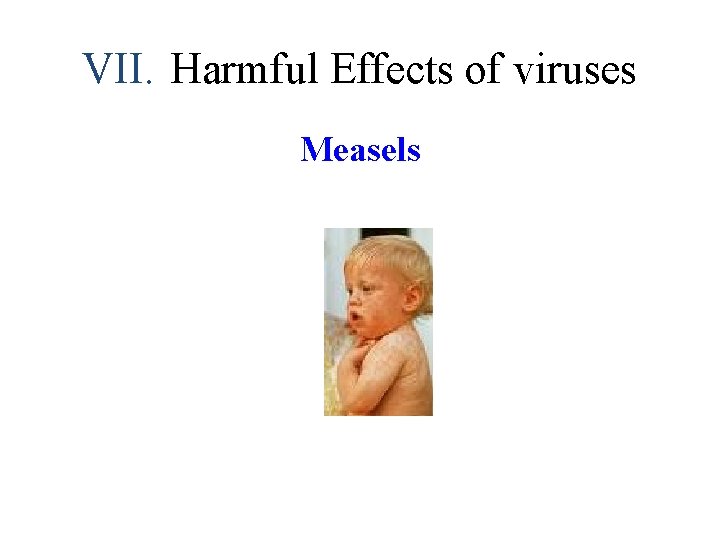 VII. Harmful Effects of viruses Measels 