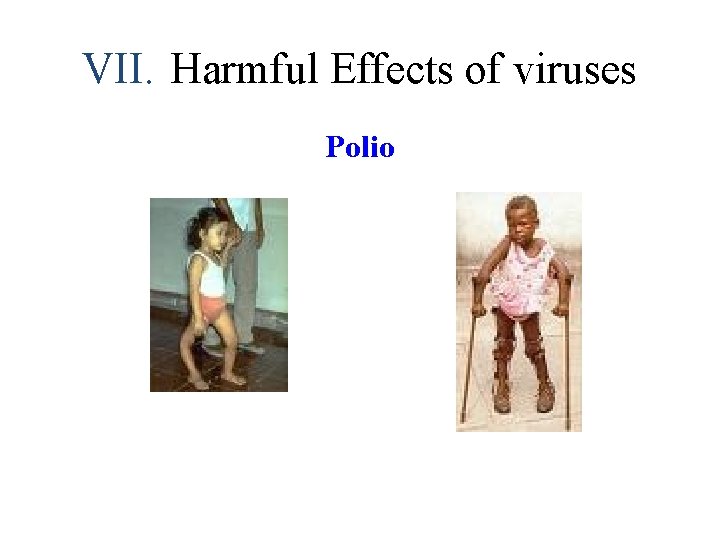 VII. Harmful Effects of viruses Polio 