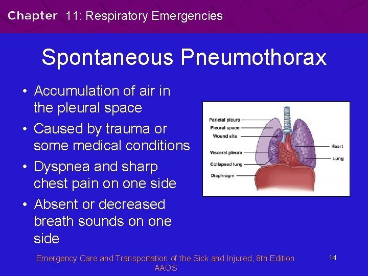 11: Respiratory Emergencies Spontaneous Pneumothorax • Accumulation of air in the pleural space •