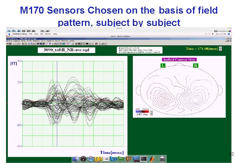 M 170 Sensors Chosen on the basis of field pattern, subject by subject 42
